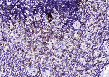 CD8 Recombinant Rabbit Monoclonal Antibody