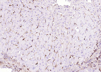 CD206 Recombinant Rabbit Monoclonal Antibody