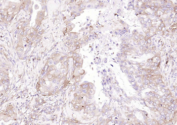 CD206 Recombinant Rabbit Monoclonal Antibody