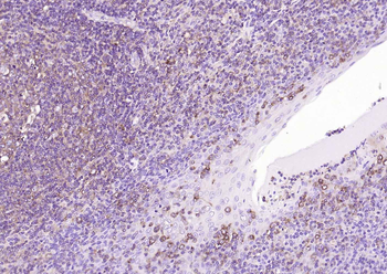 CD206 Recombinant Rabbit Monoclonal Antibody