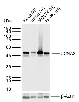 CCNA2 Recombinant Rabbit Monoclonal Antibody