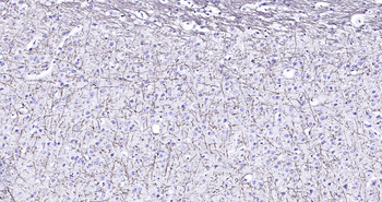 Mouse MBP Ready-To-Use IHC Kit