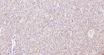 Human MBP Ready-To-Use IHC Kit