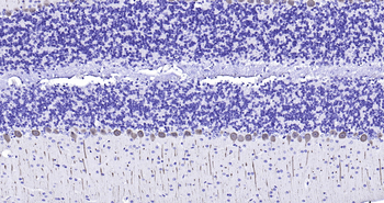 Mouse Calbindin Ready-To-Use IHC Kit