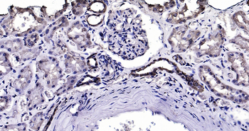 Calbindin Ready-To-Use IHC Kit