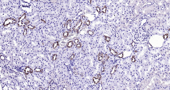 Calbindin Ready-To-Use IHC Kit