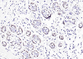 P63 Recombinant Rabbit Monoclonal Antibody
