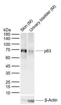 P63 Recombinant Rabbit Monoclonal Antibody