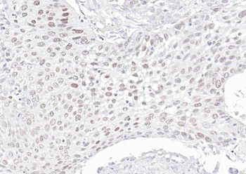 P63 Recombinant Rabbit Monoclonal Antibody