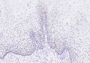 P63 Recombinant Rabbit Monoclonal Antibody