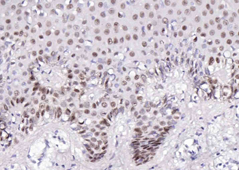 P63 Recombinant Rabbit Monoclonal Antibody