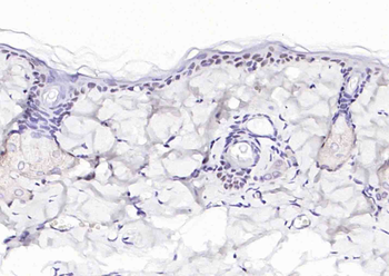 P63 Recombinant Rabbit Monoclonal Antibody
