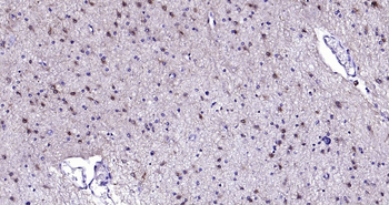 S100B Ready-To-Use IHC Kit