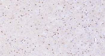 S100B Ready-To-Use IHC Kit