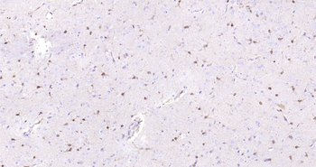 S100B Ready-To-Use IHC Kit