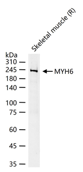 MYH6 Recombinant Rabbit Monoclonal Antibody