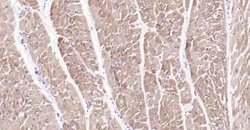 MYH6 Recombinant Rabbit Monoclonal Antibody
