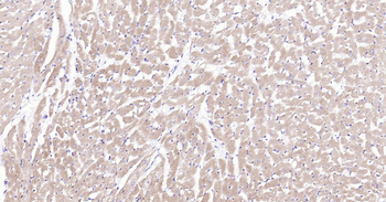 MYH6 Recombinant Rabbit Monoclonal Antibody