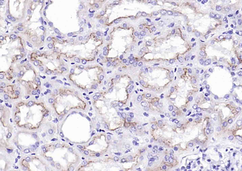 Cubilin Recombinant Rabbit Monoclonal Antibody