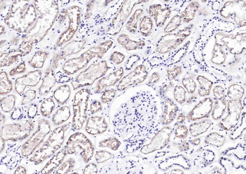 Cubilin Recombinant Rabbit Monoclonal Antibody