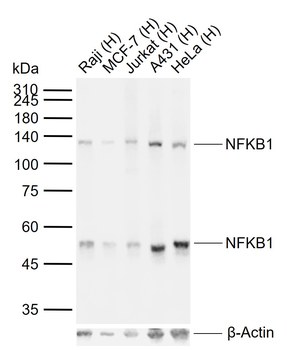NFKB1 Recombinant Rabbit Monoclonal Antibody