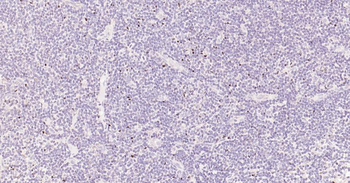 FOXP3 Recombinant Rabbit Monoclonal Antibody