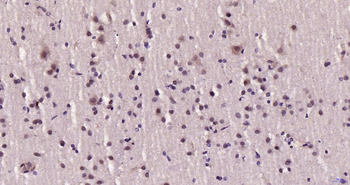 FGF14 Rabbit Polyclonal Antibody