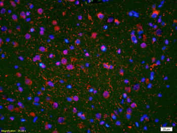 BNP Rabbit Polyclonal Antibody