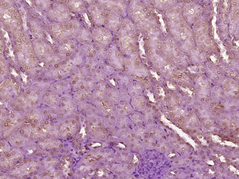 WT1 Rabbit Polyclonal Antibody