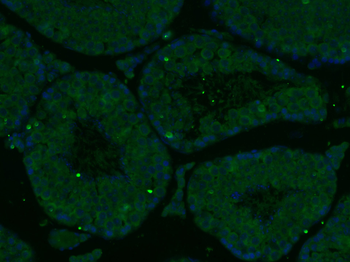 WT1 Rabbit Polyclonal Antibody