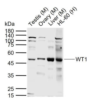 WT1 Rabbit Polyclonal Antibody