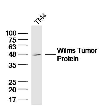 WT1 Rabbit Polyclonal Antibody