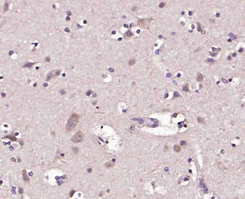 HnRNP U Rabbit Polyclonal Antibody