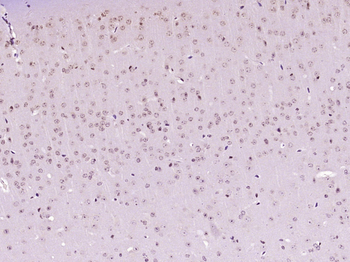 HnRNP U Rabbit Polyclonal Antibody