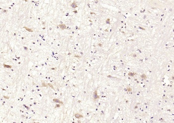 Ankyrin B Rabbit Polyclonal Antibody