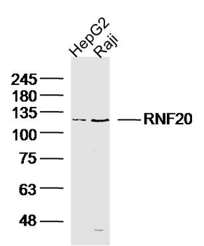 RNF20 Rabbit Polyclonal Antibody