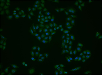 SGK1 Rabbit Polyclonal Antibody