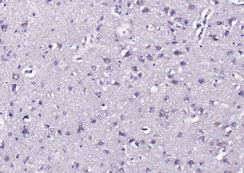 SGK1 Rabbit Polyclonal Antibody