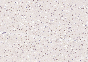 SGK1 Rabbit Polyclonal Antibody