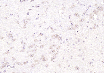 SGK1 Rabbit Polyclonal Antibody