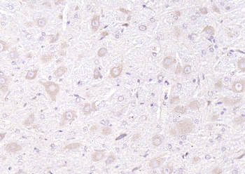 SGK1 Rabbit Polyclonal Antibody