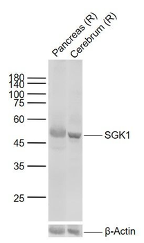 SGK1 Rabbit Polyclonal Antibody