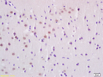 KMT1C Rabbit Polyclonal Antibody