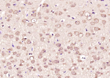 COPS2 Rabbit Polyclonal Antibody