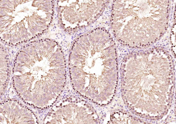 COPS2 Rabbit Polyclonal Antibody