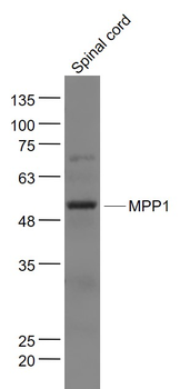 MPP1 Rabbit Polyclonal Antibody