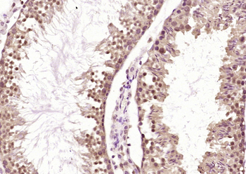 WDFY3 Rabbit Polyclonal Antibody