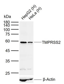 TMPRSS2 Rabbit Polyclonal Antibody