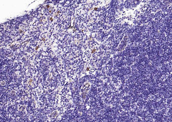 TLR2 Recombinant Rabbit Monoclonal Antibody