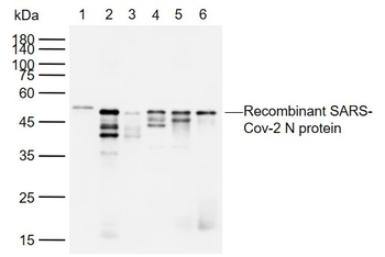 SARS-CoV-2 (2019-nCoV) Nucleocapsid Mouse Monoclonal Antibody